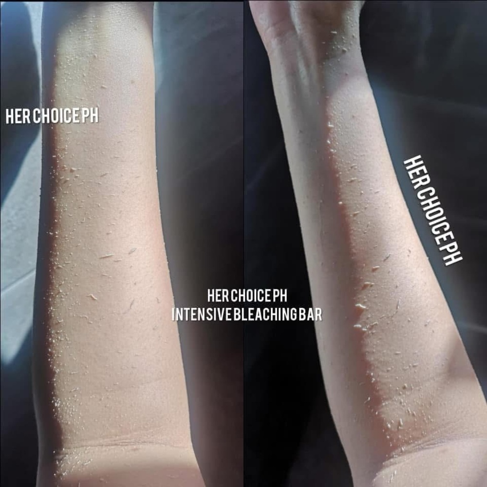 HER Choice Ph INTENSE BLEACHING BAR SOAP. - Picture 7 of 15